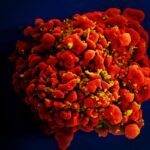 Célula infectada por partículas do vírus HIV, anexas à superfície. — Foto: National Institute of Allergy and Infectious Diseases (NIAID)