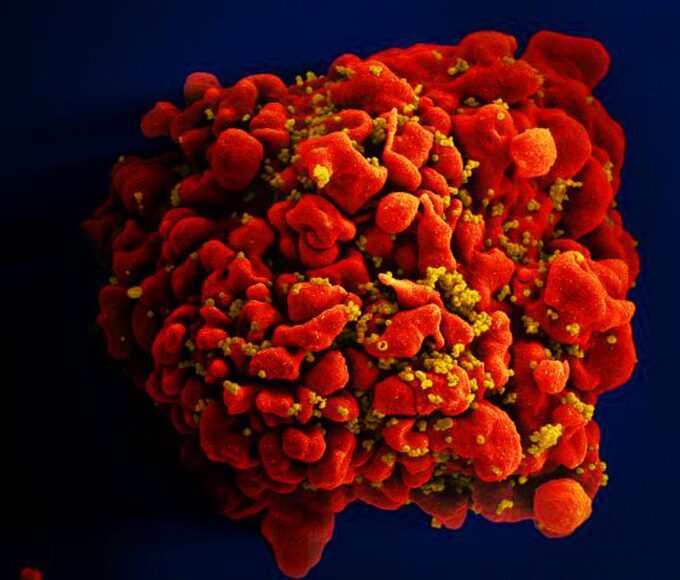 Célula infectada por partículas do vírus HIV, anexas à superfície. — Foto: National Institute of Allergy and Infectious Diseases (NIAID)