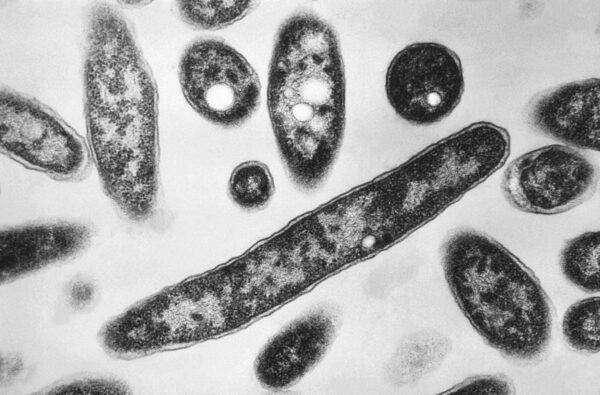 Esta imagem de microscopia eletrônica de 1978, disponibilizada pelos Centros de Controle e Prevenção de Doenças (CDC), mostra a bactéria Legionella pneumophila, responsável pela doença pneumônica conhecida como doença dos legionários. — Foto: Francis Chandler/CDC via AP, Arquivo